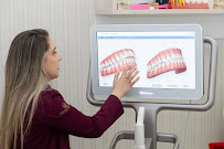 Implantes Dentários | Dentista | Odonto Schoba | Piracicaba - SP