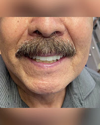 Odontologia por Especialistas Implantes Dentales