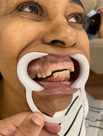 Encanttá Odontologia | Implante Dentário | Dentista | Alto | Piracicaba - SP