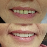 Erika Perroni Odontologia Estética