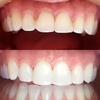Erika Perroni Odontologia Estética