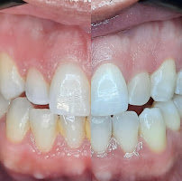 Erika Perroni Odontologia Estética
