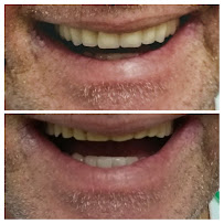 Erika Perroni Odontologia Estética