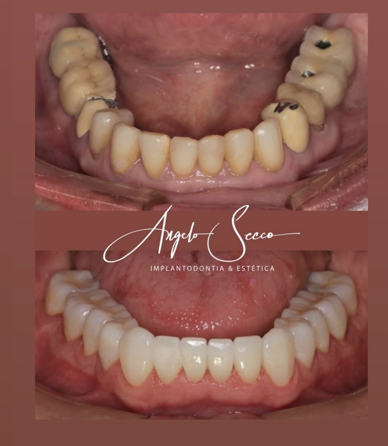 Dr Angelo Secco - dental clinic in Piracicaba