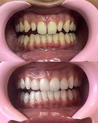 Clínica Dra Mariana Ribeiro | DENTISTA EM BAURU