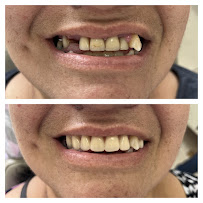 Clínica Dra Mariana Ribeiro | DENTISTA EM BAURU