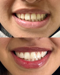 Clínica Dra Mariana Ribeiro | DENTISTA EM BAURU