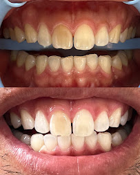 Clínica Dra Mariana Ribeiro | DENTISTA EM BAURU