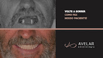 Avelar Odontologia | Implante Dentário | Lente de Contato Dental | Jardim Amalia | Bauru - SP