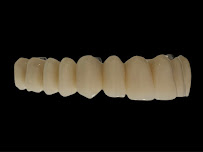 OdontoCirurgia | Implantes Dentários em Bauru