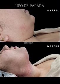 Evolve Odontologia