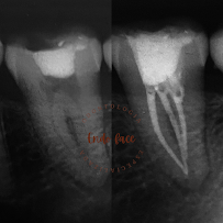 Dentista em Bauru 24h - Dra Mirela Barros