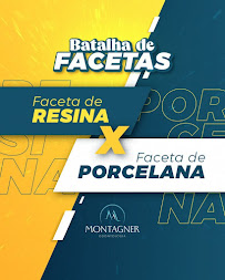 Implante Dentário | Invisalign | Montagner Odontologia | Centro | Foz do Iguaçu - PR