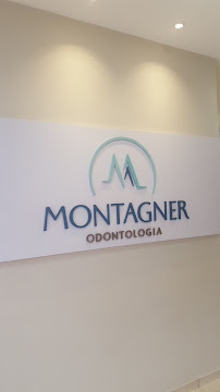 Implante Dentário | Invisalign | Montagner Odontologia | Centro | Foz do Iguaçu - PR