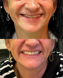 Vila A Odontologia | Implantes Dentários em Foz do Iguaçu