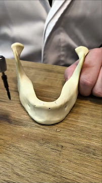 Vila A Odontologia | Implantes Dentários em Foz do Iguaçu