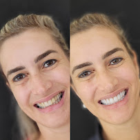 Dr. Douglas Ricceri - Facetas em Resina Composta, Clareamento Dental e Clínico-Geral