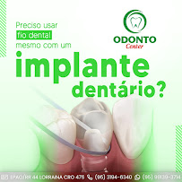 Clínica Odonto Center Tancredo Neves: Dentista, Aparelho, Prótese, Implante