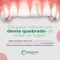Clínica Odonto Center Tancredo Neves: Dentista, Aparelho, Prótese, Implante