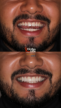Ortho Dental Life