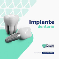 Clínica Odontológica Potenza Dentalle - Implantes e Clínico