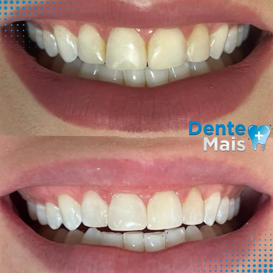 Dente Mais - dental clinic in Palmas, Brazil