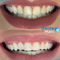 Dente Mais in Palmas, Brazil
