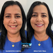 Dente Mais