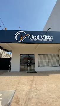 Oral Vitta – Implantes Dentários em Palmas