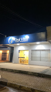 Oral Vitta – Implantes Dentários em Palmas
