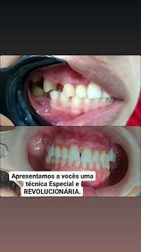 Clínicas Zanetti - Odontologia Estética e Reabilitação Oral | Palmas | Tocantins TO |