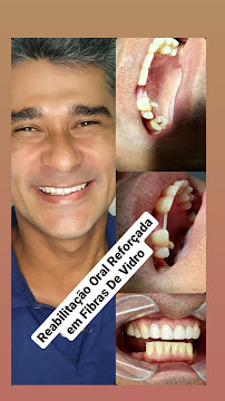 Clínicas Zanetti - Odontologia Estética e Reabilitação Oral | Palmas | Tocantins TO |