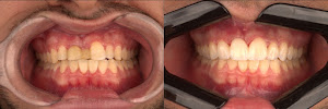 Dr Flavio Fregonesi - Dentista em Palmas/TO