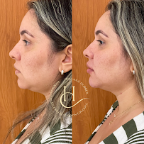 Dra. Hollana Correa - Harmonização Facial e Odontologia