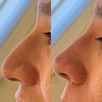 Dra. Hollana Correa - Harmonização Facial e Odontologia