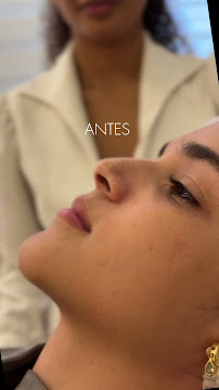 Dra. Hollana Correa - Harmonização Facial e Odontologia