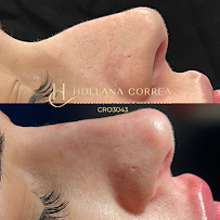 Dra. Hollana Correa - Harmonização Facial e Odontologia