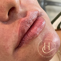 Dra. Hollana Correa - Harmonização Facial e Odontologia