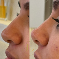 Dra. Hollana Correa - Harmonização Facial e Odontologia