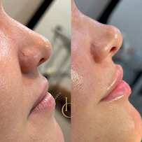 Dra. Hollana Correa - Harmonização Facial e Odontologia