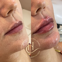 Dra. Hollana Correa - Harmonização Facial e Odontologia