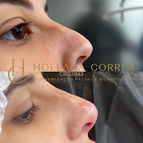 Dra. Hollana Correa - Harmonização Facial e Odontologia