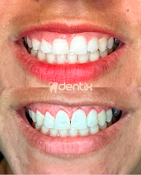 Dentix Petrolina in Petrolina, Brazil