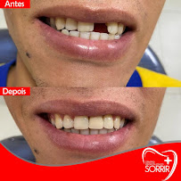SORRIR MAIS (UNIDADE AREIA BRANCA)