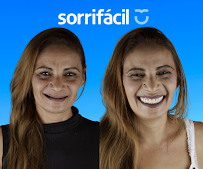Sorrifácil Petrolina | Implantes Dentários, Prótese Protocolo e Reabilitação Oral