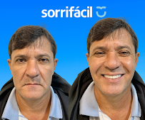 Sorrifácil Petrolina | Implantes Dentários, Prótese Protocolo e Reabilitação Oral