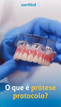 Sorrifácil Petrolina | Implantes Dentários, Prótese Protocolo e Reabilitação Oral