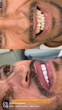 ODONTO LIDER - DENTISTA EM PETROLINA-PE