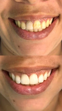 ODONTO LIDER - DENTISTA EM PETROLINA-PE