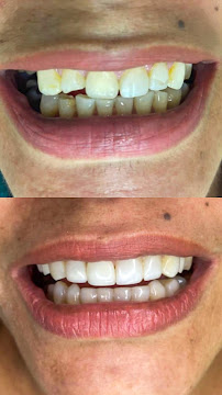 ODONTO LIDER - DENTISTA EM PETROLINA-PE